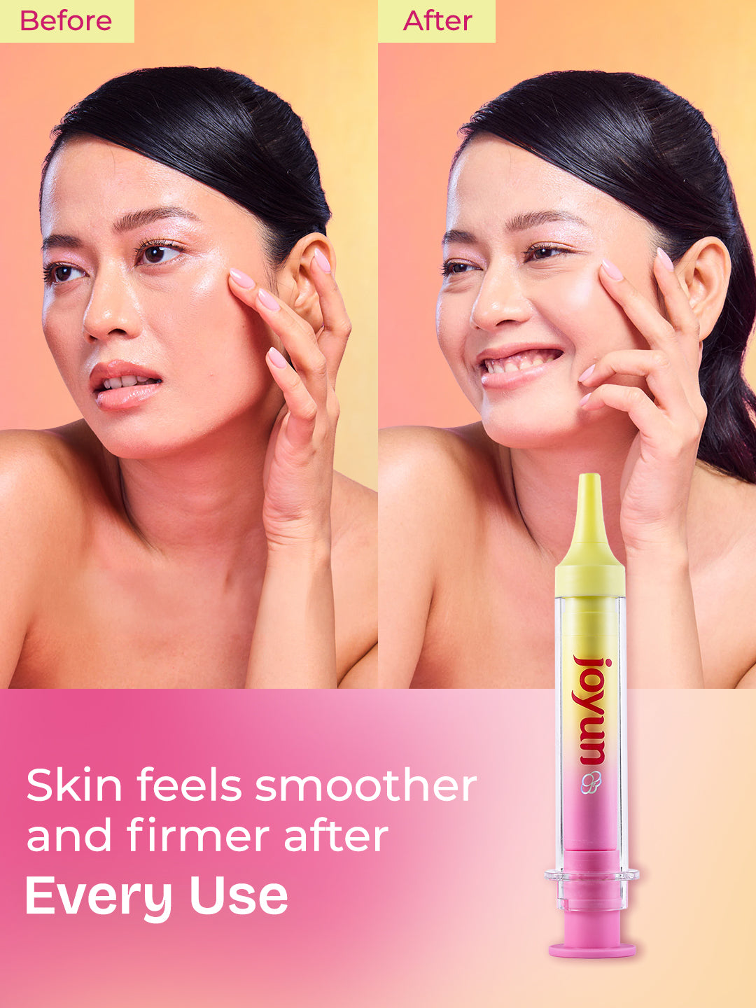 Rose PDRN Young & Fresh Microneedle Serum (4000 PPM)